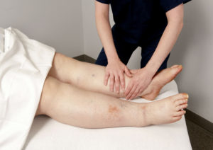 certified lymphedema therapists